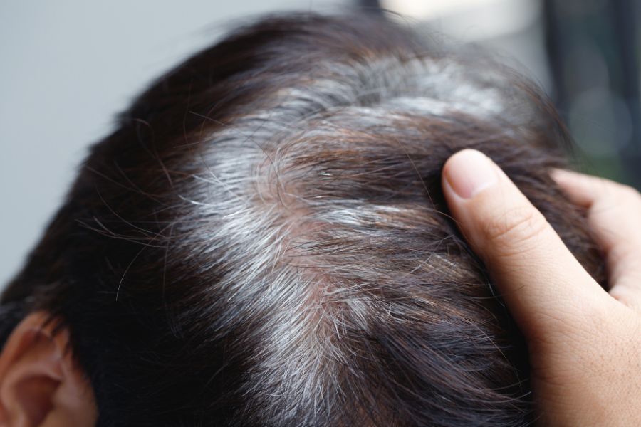 does spermidine help to get rid of grey hair